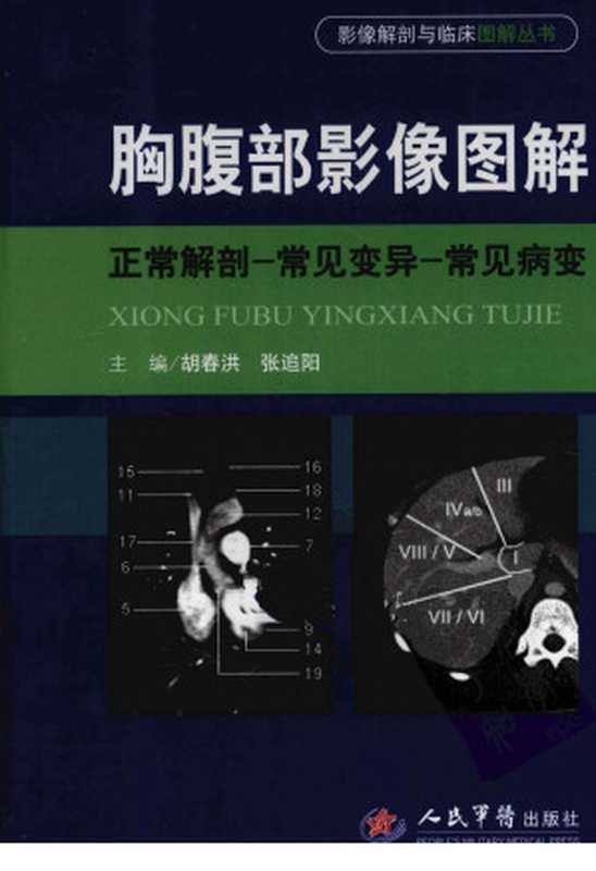 胸腹部影像图解 正常解剖-常见变异-常见病变（胡春洪，张追阳主编）（2013）